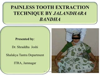 PAINLESS TOOTH EXTRACTION
TECHNIQUE BY JALANDHARA
BANDHA
Presented by:
Dr. Shraddha Joshi
Shalakya Tantra Department
ITRA, Jamnagar
Dr. Shraddha Joshi 1
 