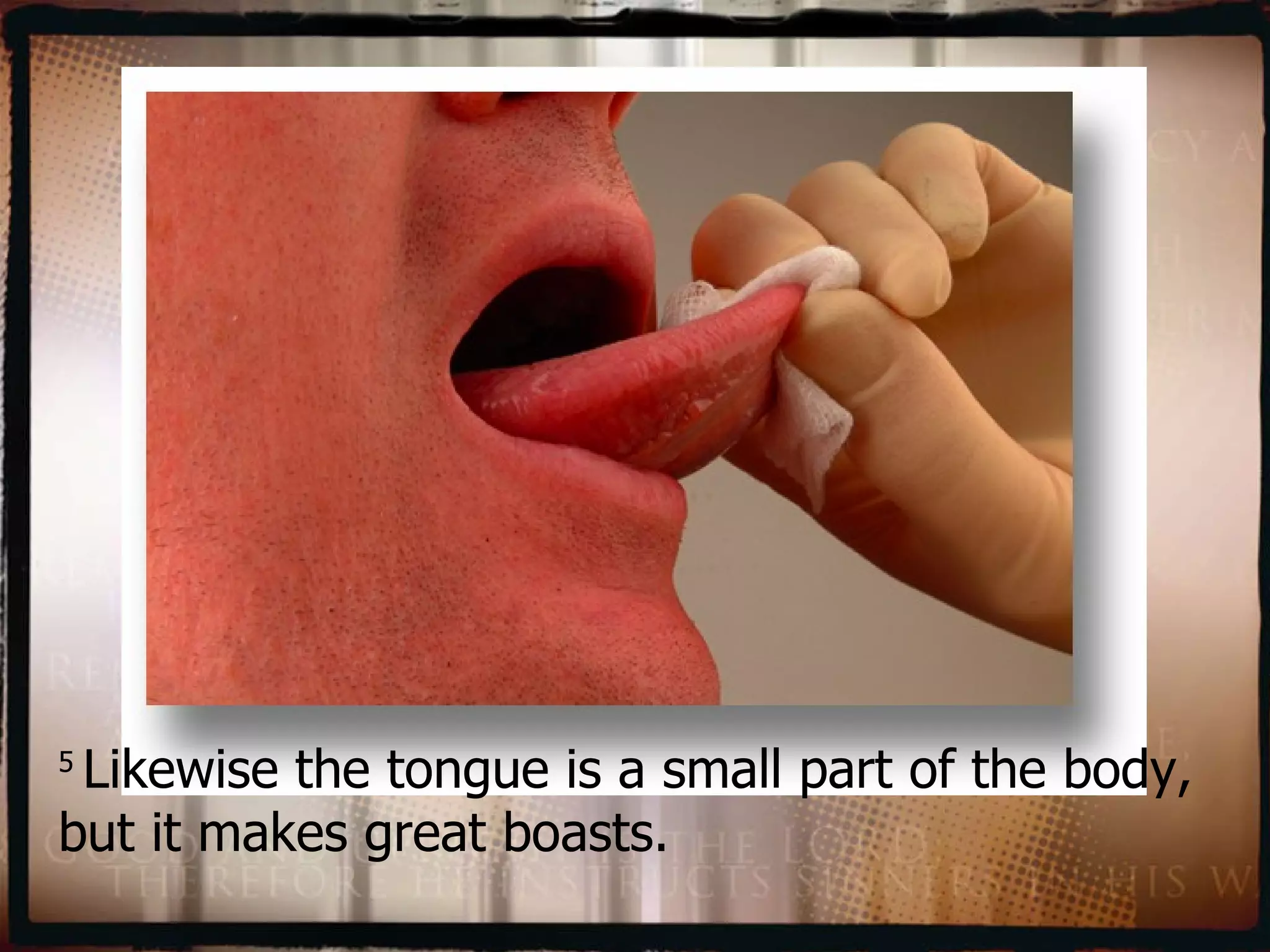 5  Likewise the tongue is a small part of the body, but it makes great boasts.  