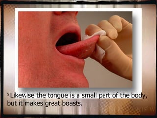 5  Likewise the tongue is a small part of the body, but it makes great boasts.  