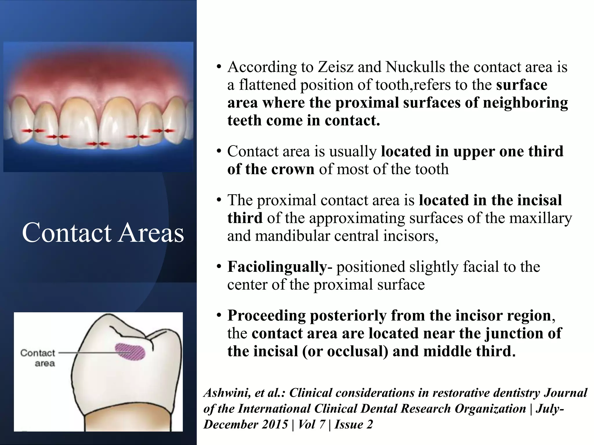 CONTACTS AND  CONTOURS IN DENTISTRY