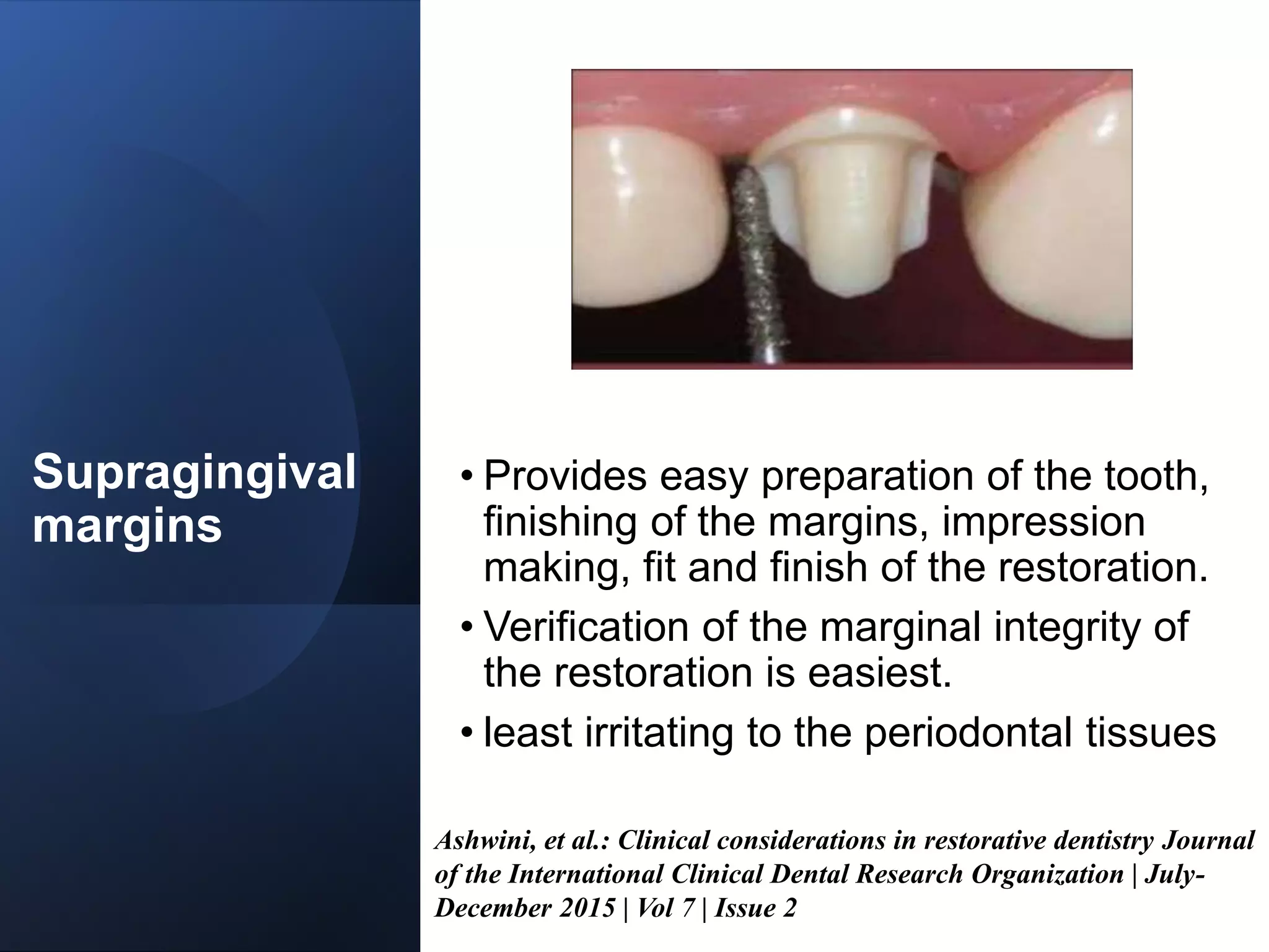 CONTACTS AND  CONTOURS IN DENTISTRY