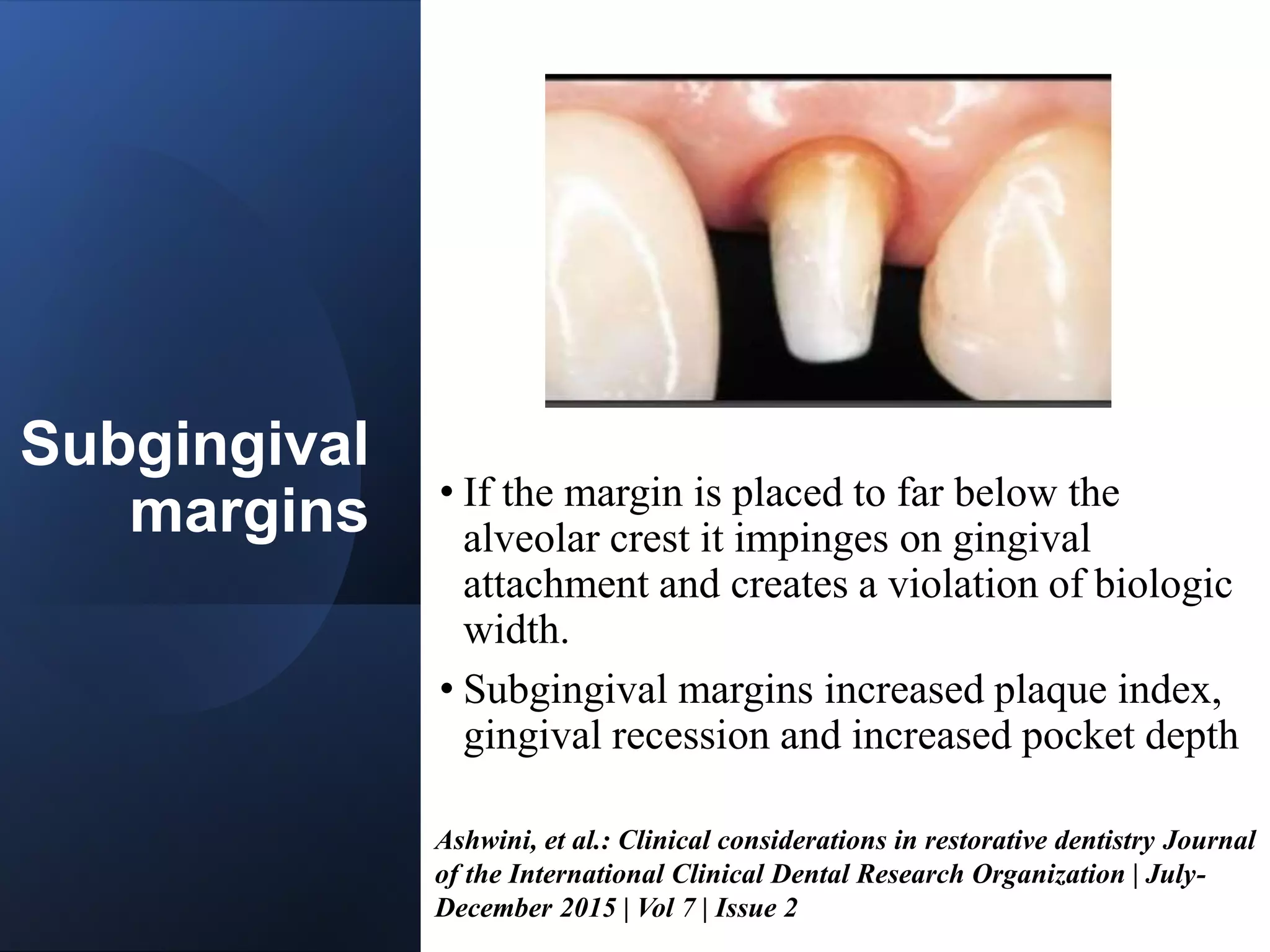 CONTACTS AND  CONTOURS IN DENTISTRY