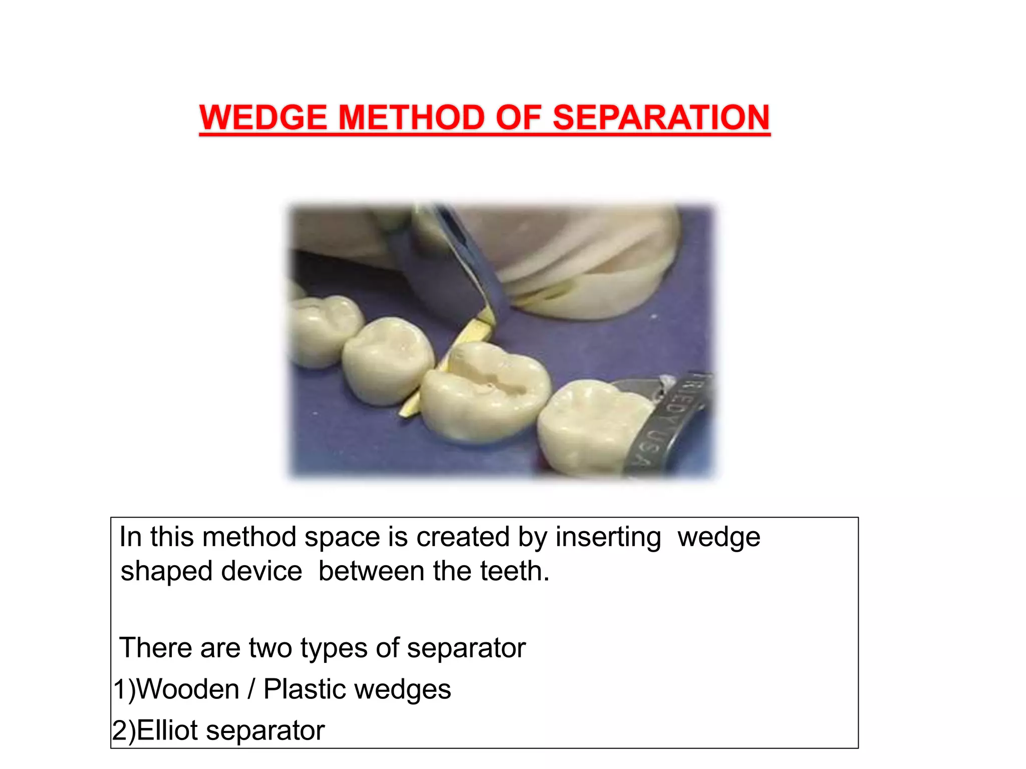 CONTACTS AND  CONTOURS IN DENTISTRY