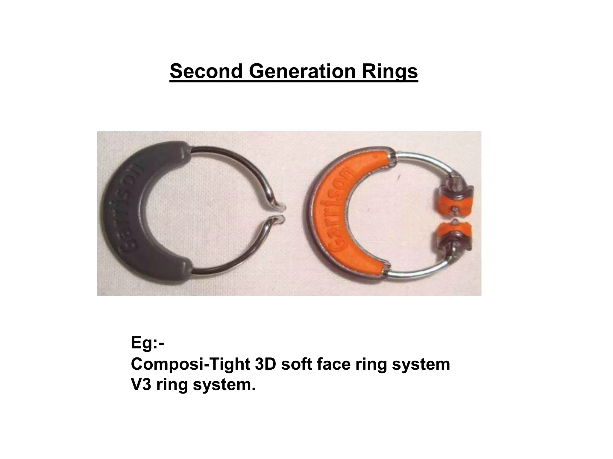 CONTACTS AND  CONTOURS IN DENTISTRY