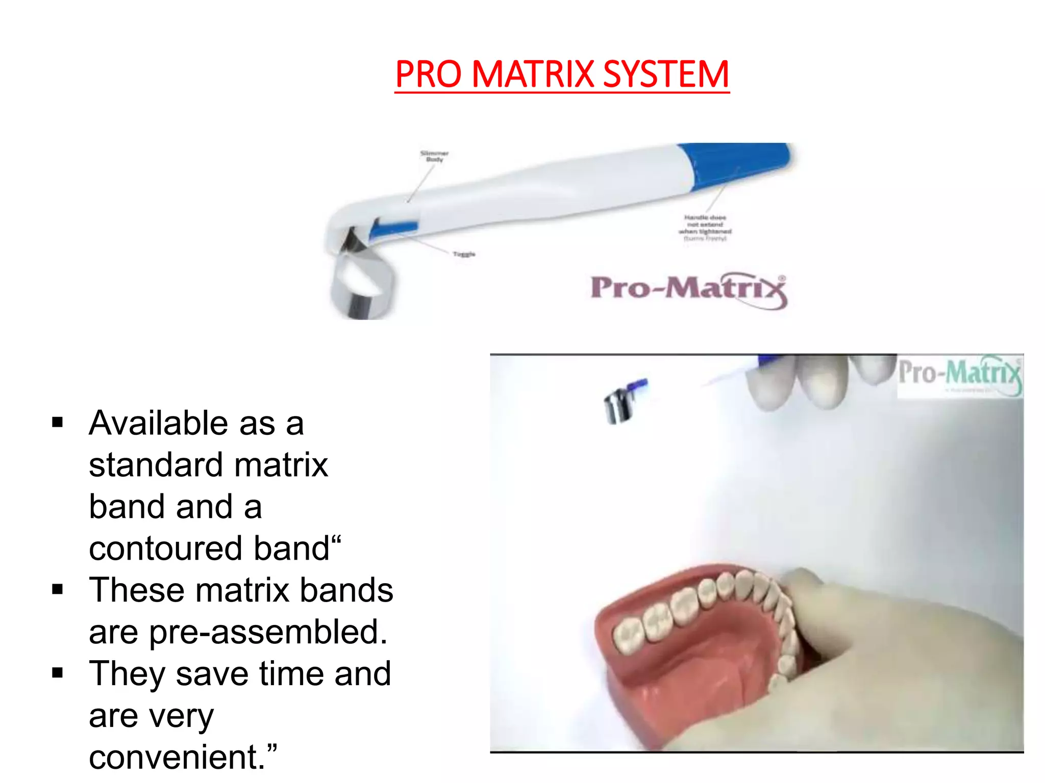 CONTACTS AND  CONTOURS IN DENTISTRY