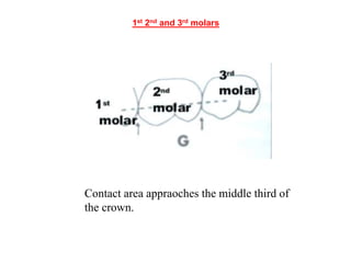 CONTACTS AND  CONTOURS IN DENTISTRY