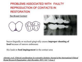 CONTACTS AND  CONTOURS IN DENTISTRY