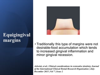 CONTACTS AND  CONTOURS IN DENTISTRY