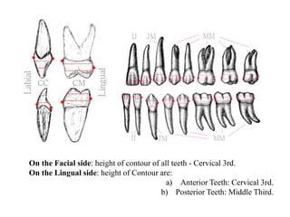 CONTACTS AND  CONTOURS IN DENTISTRY