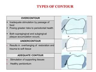 CONTACTS AND  CONTOURS IN DENTISTRY