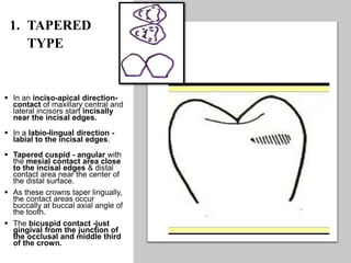 CONTACTS AND  CONTOURS IN DENTISTRY
