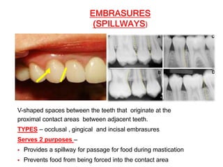 CONTACTS AND  CONTOURS IN DENTISTRY
