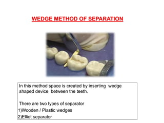 CONTACTS AND  CONTOURS IN DENTISTRY