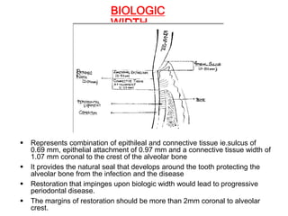CONTACTS AND  CONTOURS IN DENTISTRY
