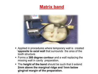 CONTACTS AND  CONTOURS IN DENTISTRY