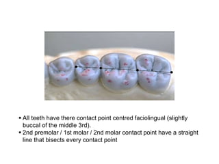 CONTACTS AND  CONTOURS IN DENTISTRY