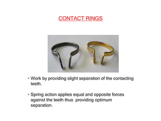 CONTACTS AND  CONTOURS IN DENTISTRY