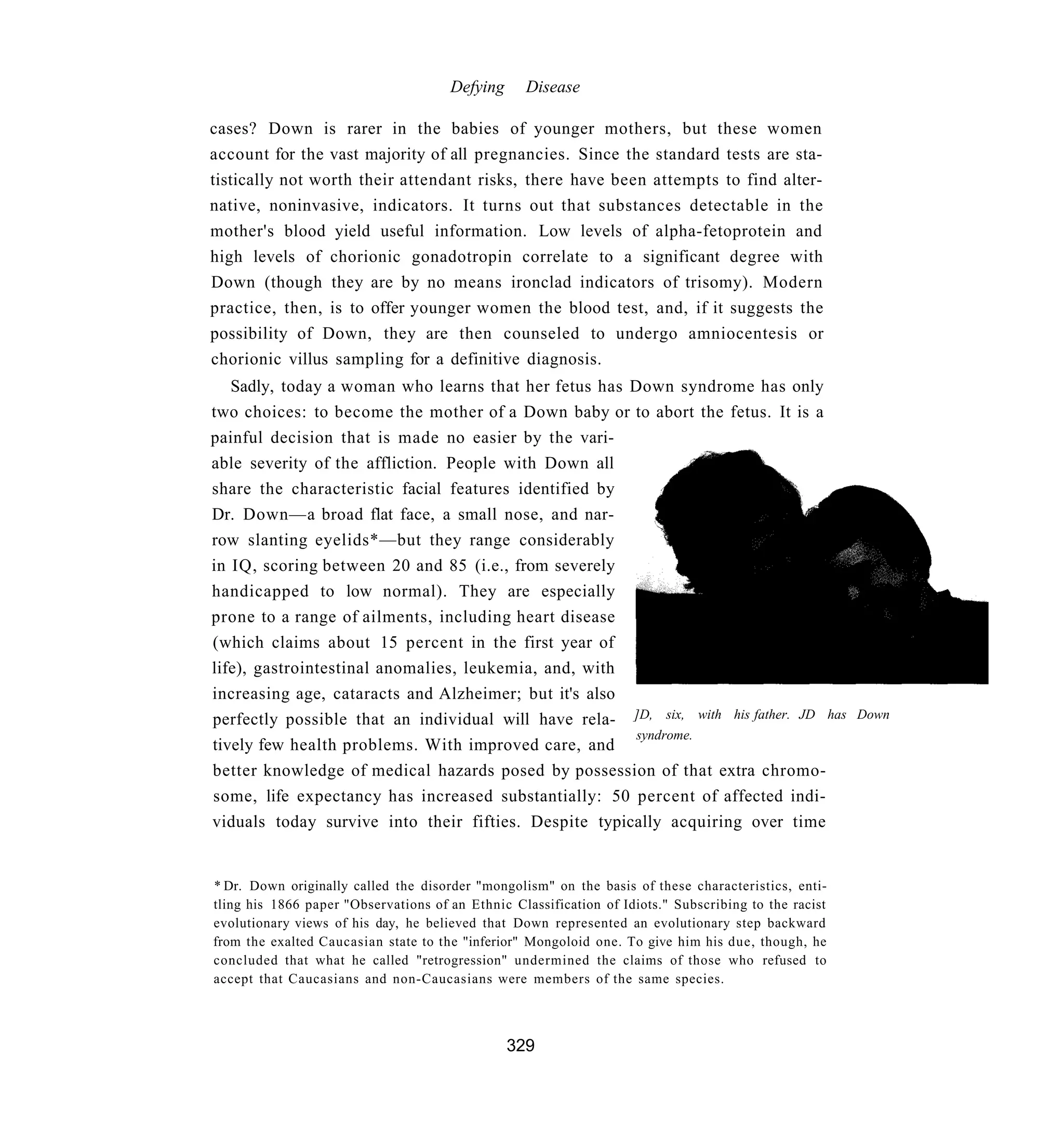 Defying     Disease

cases? Down is rarer in the babies of younger mothers, but these women
account for the vast majority of all pregnancies. Since the standard tests are sta-
tistically not worth their attendant risks, there have been attempts to find alter-
native, noninvasive, indicators. It turns out that substances detectable in the
mother's blood yield useful information. Low levels of alpha-fetoprotein and
high levels of chorionic gonadotropin correlate to a significant degree with
Down (though they are by no means ironclad indicators of trisomy). Modern
practice, then, is to offer younger women the blood test, and, if it suggests the
possibility of Down, they are then counseled to undergo amniocentesis or
chorionic villus sampling for a definitive diagnosis.
   Sadly, today a woman who learns that her fetus has Down syndrome has only
two choices: to become the mother of a Down baby or to abort the fetus. It is a
painful decision that is made no easier by the vari-
able severity of the affliction. People with Down all
share the characteristic facial features identified by
Dr. Down—a broad flat face, a small nose, and nar-
row slanting eyelids*—but they range considerably
in IQ, scoring between 20 and 85 (i.e., from severely
handicapped to low normal). They are especially
prone to a range of ailments, including heart disease
(which claims about 15 percent in the first year of
life), gastrointestinal anomalies, leukemia, and, with
increasing age, cataracts and Alzheimer; but it's also
perfectly possible that an individual will have rela- ]D, six, with his father. JD has Down
                                                       syndrome.
tively few health problems. With improved care, and
better knowledge of medical hazards posed by possession of that extra chromo-
some, life expectancy has increased substantially: 50 percent of affected indi-
viduals today survive into their fifties. Despite typically acquiring over time


* Dr. Down originally called the disorder "mongolism" on the basis of these characteristics, enti-
tling his 1866 paper "Observations of an Ethnic Classification of Idiots." Subscribing to the racist
evolutionary views of his day, he believed that Down represented an evolutionary step backward
from the exalted Caucasian state to the "inferior" Mongoloid one. To give him his due, though, he
concluded that what he called "retrogression" undermined the claims of those who refused to
accept that Caucasians and non-Caucasians were members of the same species.



                                                329
 