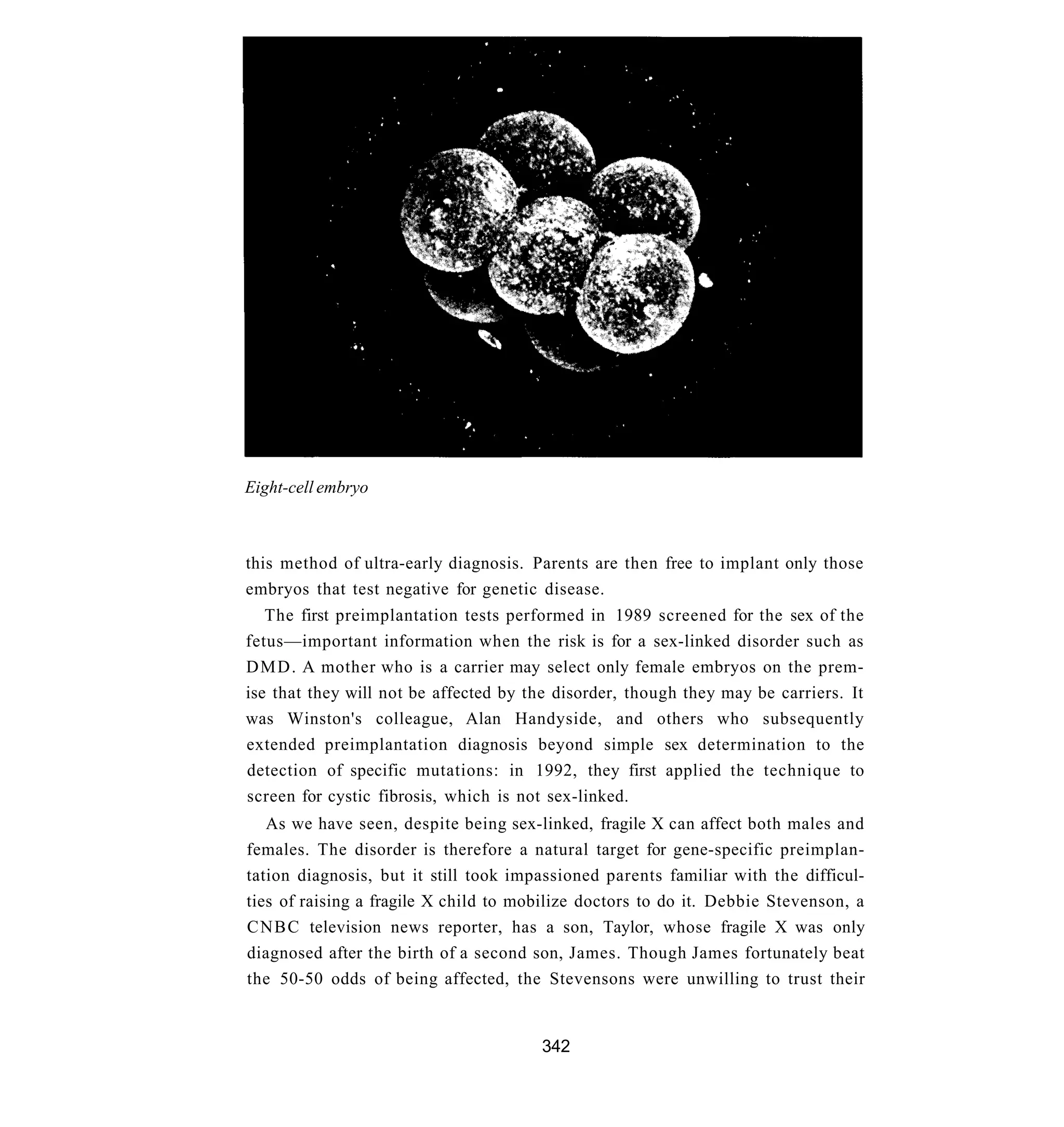 Eight-cell embryo



this method of ultra-early diagnosis. Parents are then free to implant only those
embryos that test negative for genetic disease.
   The first preimplantation tests performed in 1989 screened for the sex of the
fetus—important information when the risk is for a sex-linked disorder such as
D M D . A mother who is a carrier may select only female embryos on the prem-
ise that they will not be affected by the disorder, though they may be carriers. It
was Winston's colleague, Alan Handyside, and others who subsequently
extended preimplantation diagnosis beyond simple sex determination to the
detection of specific mutations: in 1992, they first applied the technique to
screen for cystic fibrosis, which is not sex-linked.
   As we have seen, despite being sex-linked, fragile X can affect both males and
females. The disorder is therefore a natural target for gene-specific preimplan-
tation diagnosis, but it still took impassioned parents familiar with the difficul-
ties of raising a fragile X child to mobilize doctors to do it. Debbie Stevenson, a
C N B C television news reporter, has a son, Taylor, whose fragile X was only
diagnosed after the birth of a second son, James. Though James fortunately beat
the 50-50 odds of being affected, the Stevensons were unwilling to trust their


                                       342
 