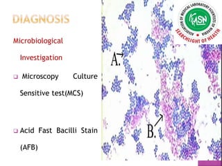 Microbiological
Investigation
 Microscopy Culture
Sensitive test(MCS)
 Acid Fast Bacilli Stain
(AFB)
 