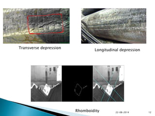 Transverse depression
Longitudinal depression
Rhomboidity 22-08-2014 12
 