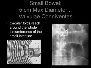Valvulae Interpreting chest & abdominal radiographs - Mr Jamie Dunn | PPT