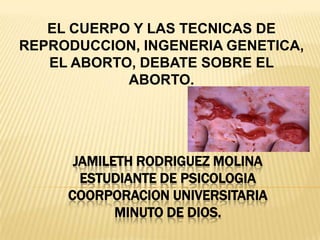 EL CUERPO Y LAS TECNICAS DE
REPRODUCCION, INGENERIA GENETICA,
   EL ABORTO, DEBATE SOBRE EL
            ABORTO.




      JAMILETH RODRIGUEZ MOLINA
       ESTUDIANTE DE PSICOLOGIA
     COORPORACION UNIVERSITARIA
            MINUTO DE DIOS.
 