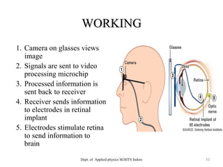 WORKINGWORKING
Dept. of Applied physics SGSITS Indore 10
1. Camera on glasses views
image
2. Signals are sent to video
processing microchip
3. Processed information is
sent back to receiver
4. Receiver sends information
to electrodes in retinal
implant
5. Electrodes stimulate retina
to send information to
brain
 