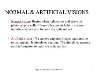 NORMAL & ARTIFICIAL VISIONSNORMAL & ARTIFICIAL VISIONS
Dept. of Applied physics SGSITS Indore 12
• Normal vision- Begins when light enters and strike on
photoreceptor cells. These cells convert light to electric
impulses that are sent to brain via optic nerves.
• Artificial vision- The camera captures images and sends to
retina implant. It stimulates neurons. The stimulated neurons
send information to brain via optic nerves.
 