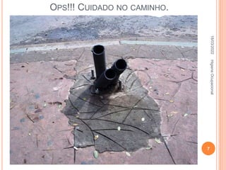 OPS!!! CUIDADO NO CAMINHO.
Mas não acaba ai não, nas
modificações da praça deixam restos das
anteriores, na fotografia encontramos
conduites e os parafusos com
aproximadamente 8 cm, do poste metálico
de uma luminária que havia
anteriormente.
Aqui o acidente pode ser mais grave,
imagine uma pessoa caindo com a testa na
ponta destes parafusos.
18/03/2022
7
Higiene
Ocupacional
 