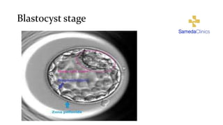 Blastocyst stage
 