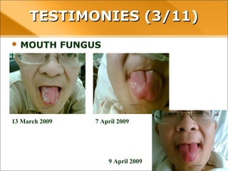 • MOUTH FUNGUS
TESTIMONIES (3/11)TESTIMONIES (3/11)
13 March 2009 7 April 2009
9 April 2009
 