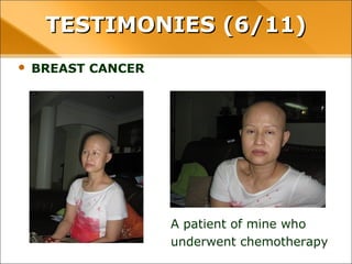 • BREAST CANCER
TESTIMONIES (6/11)TESTIMONIES (6/11)
A patient of mine who
underwent chemotherapy
 