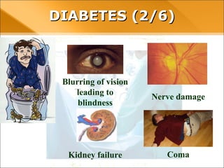 DIABETES (2/6)
ComaKidney failure
Blurring of vision
leading to
blindness
Nerve damage
 