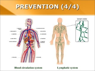 Blood circulation system Lymphatic system
PREVENTION (4/4)PREVENTION (4/4)
 