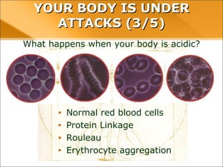 YOUR BODY IS UNDER ATTACKS (3/5)
What happens when your body is acidic?
• Normal red blood cells
• Protein Linkage
• Rouleau
• Erythrocyte aggregation
 