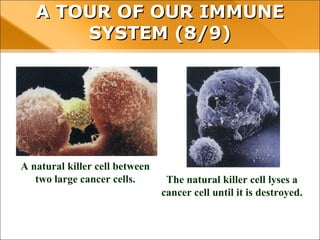 A natural killer cell between
two large cancer cells.
A TOUR OF OUR IMMUNE SYSTEM (8/9)
The natural killer cell lyses a
cancer cell until it is destroyed.
 