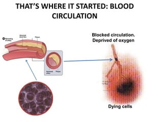 THAT’S WHERE IT STARTED: BLOOD
CIRCULATION
Dying cells
Blocked circulation.
Deprived of oxygen
 