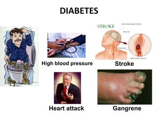 DIABETES
Stroke
Heart attack
High blood pressure
Gangrene
 