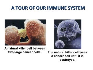 A natural killer cell between
two large cancer cells. The natural killer cell lyses
a cancer cell until it is
destroyed.
A TOUR OF OUR IMMUNE SYSTEM
 