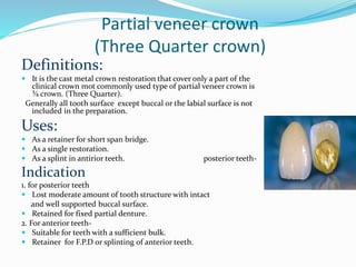 Partial veneer crown
(Three Quarter crown)
Definitions:
 It is the cast metal crown restoration that cover only a part of the
clinical crown mot commonly used type of partial veneer crown is
¾ crown. (Three Quarter).
Generally all tooth surface except buccal or the labial surface is not
included in the preparation.
Uses:
 As a retainer for short span bridge.
 As a single restoration.
 As a splint in antirior teeth. posterior teeth-
Indication
1. for posterior teeth
 Lost moderate amount of tooth structure with intact
and well supported buccal surface.
 Retained for fixed partial denture.
2. For anterior teeth-
 Suitable for teeth with a sufficient bulk.
 Retainer for F.P.D or splinting of anterior teeth.
 