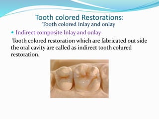 Tooth colored Restorations:
Tooth colored inlay and onlay
 Indirect composite Inlay and onlay
Tooth colored restoration which are fabricated out side
the oral cavity are called as indirect tooth colured
restoration.
 