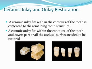Ceramic Inlay and Onlay Restoration
 A ceramic inlay fits with in the contours of the tooth is
cemented to the remaining tooth structure.
 A ceramic onlay fits within the contours of the tooth
and covers part or all the occlusal surface needed to be
restored
 