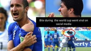 Bite during the world cup went viral on 
social media 
 