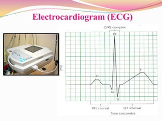 Electrocardiogram (ECG)
 