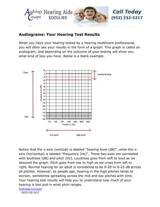 Audiograms: Your Hearing Test Results

When you have your hearing tested by a hearing healthcare professional,
you will often see your results in the form of a graph. This graph is called an
audiogram, and depending on the outcome of your testing will show you
what kind of loss you have. Below is a blank example.




Notice that the y-axis (vertical) is labeled “hearing level (dB)”, while the x-
axis (horizontal) is labeled “frequency (Hz)”. These two axes are correlated
with loudness (dB) and pitch (Hz). Loudness goes from soft to loud as we
descend the graph. Pitch goes from low to high as we cross from left to
right. Normal hearing for an adult is considered to be 0-20 or 0-25 dB across
all pitches. However, as people age, hearing in the high pitches tends to
worsen, sometimes spreading across the mid and low pitches with time.
Your hearing test results will help you to understand how much of your
hearing is lost and in what pitch ranges.
Audiology Concepts
  (952) 232-5217
 