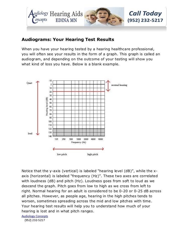Audiograms your hearing test results