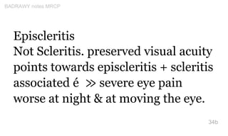 Episcleritis
Not Scleritis. preserved visual acuity
points towards episcleritis + scleritis
associated é ≫ severe eye pain...