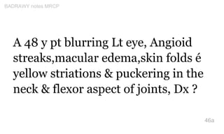 A 48 y pt blurring Lt eye, Angioid
streaks,macular edema,skin folds é
yellow striations & puckering in the
neck & flexor a...