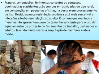 • Fraturas, amputações, ferimentos cortantes ou contusos,
queimaduras e acidentes , são comuns em atividades do tipo rural,
em construção, em pequenas oficinas, na pesca e em processamento
de lixo. Devido a pouca resistência, a criança está mais suscetível a
infecções e lesões em relação ao adulto. É comum que meninos e
meninas não apresentem peso ou tamanho suficiente para o uso de
equipamentos de proteção ou ferramentas de trabalho, destinados a
adultos, levando muitas vezes à amputação de membros e até à
morte.
 
